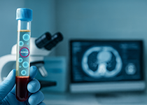 Bluttest im Reagenzglas